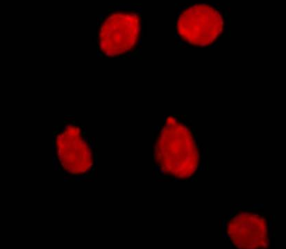 EMA-叠氮溴化乙锭