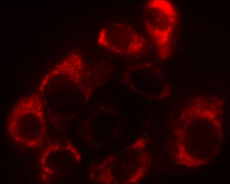 MitoMaker Red CMXRos-线粒体红色荧光